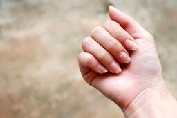لکه ی سفید روی ناخن نشانه ی چه بیماری هاییست ؟