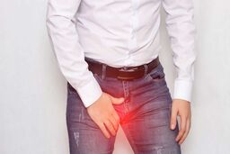 درمان عرق سوز شدن کشاله ران با 8 روش خانگی و طب سنتی