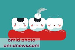 همه آن چه که باید درباره تقویت مینای دندان بدانید