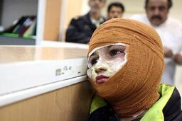 کودک یک ساله، کم سن ترین مجروح چهارشنبه پایان سال پایتخت