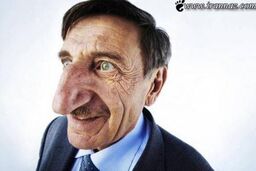 بزرگترین بینی دنیا + عکس