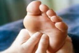 چسبی که مانع از قطع پای دیابتی می شود