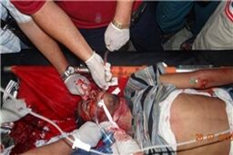 قتل عام مردم مصر