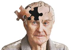 علائم و نشانه های اولیه آلزایمر