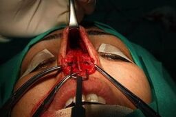 پرونده های قصور پزشکی افزایش یافته است