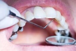 مشکلات و خبرهای خوش دندانپزشکی از زبان وزیر بهداشت