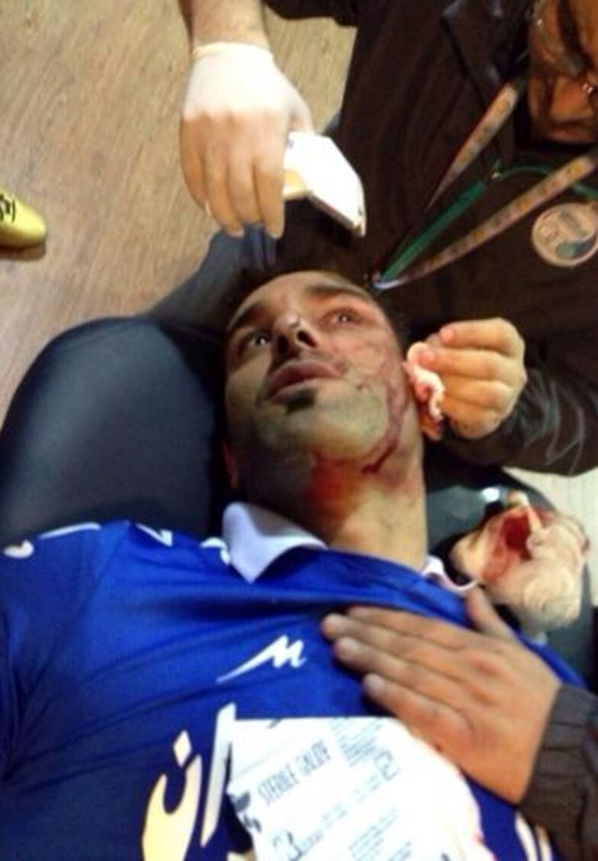 عمران زاده: صورتم به جای بخیه ۶ منگنه خورده است! / همه ایران از دیدن «پایتخت ۳» شاد هستند