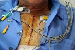 حکایت تیوپ ۳۰۰میلیونی دستگاه های MRI تا هزار خدمت سلامت که تعرفه ندارد