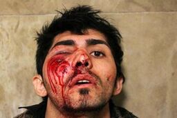 تعداد مصدومان چهارشنبه آخر سال تهران به ۲۴ نفر افزایش یافت