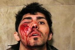 تعداد مصدومان چهارشنبه آخر سال تهران به ۲۴ نفر افزایش یافت